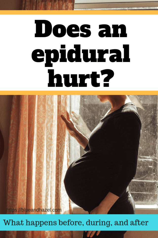 Does an epidural hurt? Here is what to expect, and how it was different for 3 births! 